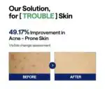 Mediheal Teatree Trouble Pad 170ml / 100pads - Image 3