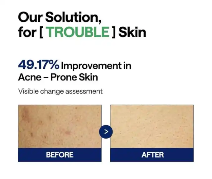 Mediheal Teatree Trouble Pad 170ml / 100pads - Image 3