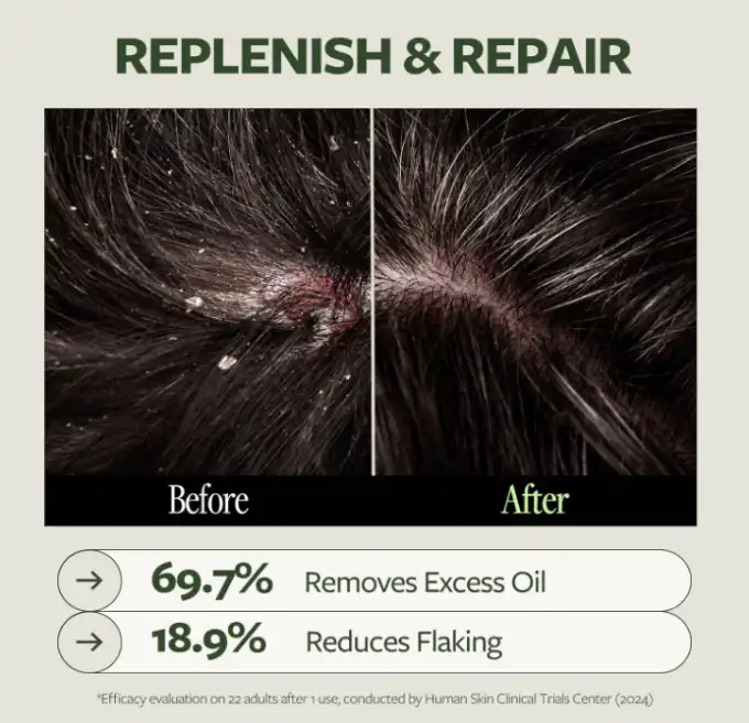Dr. 14 Revitalizing Scalp Care Shampoo - Image 6