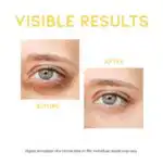 OOTD Dark Circle Eye Serum - Image 3