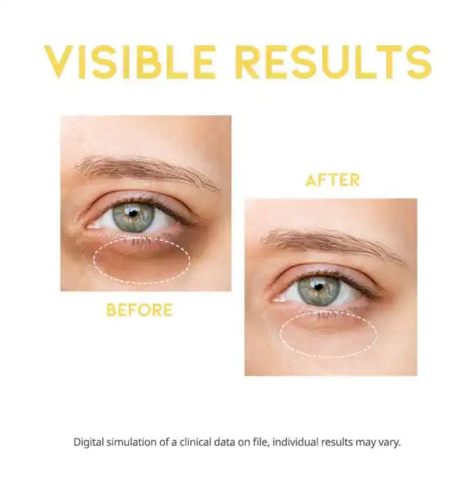 OOTD Dark Circle Eye Serum - Image 3