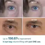 Dr. Melaxin Eyephalt Eyebag Cream - Image 3