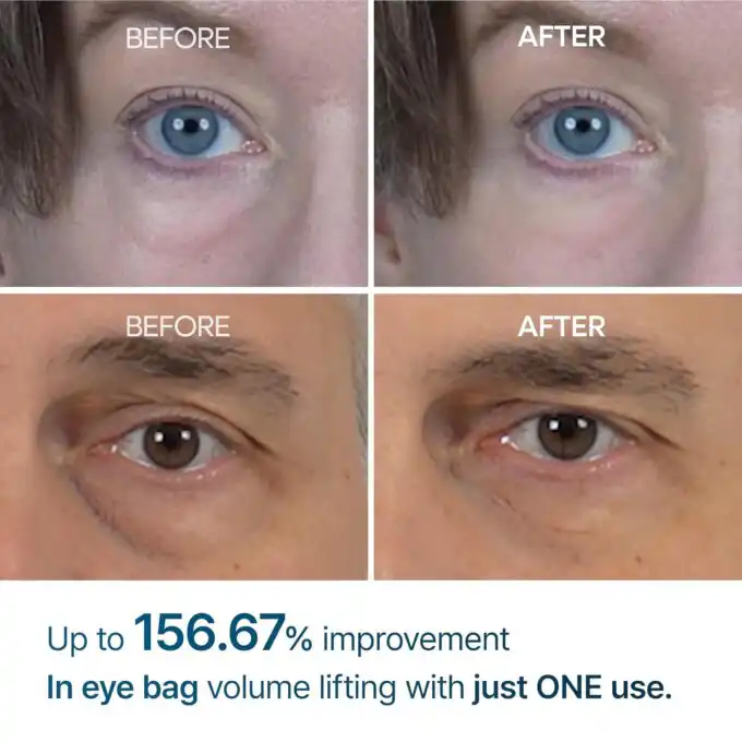 Dr. Melaxin Eyephalt Eyebag Cream - Image 3