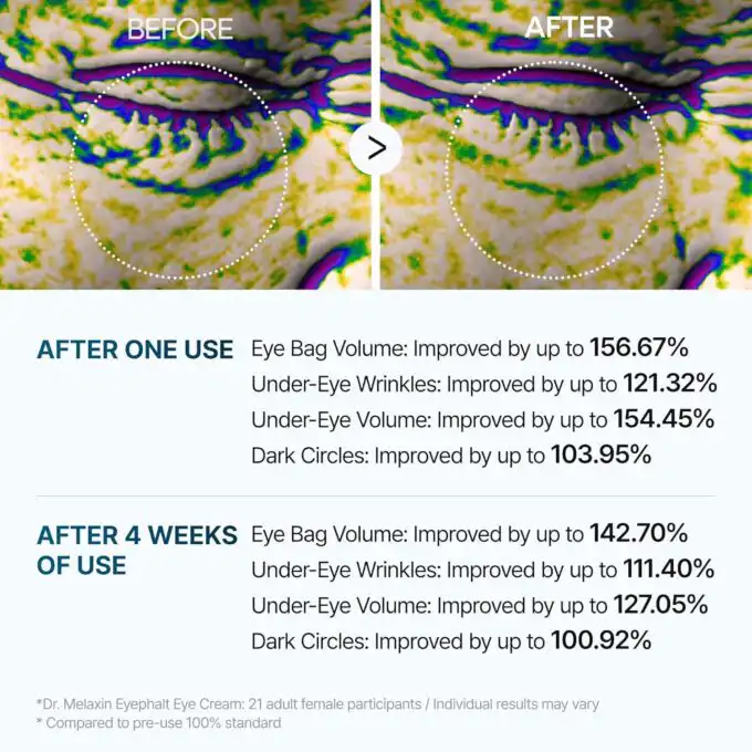 Dr. Melaxin Eyephalt Eyebag Cream - Image 8