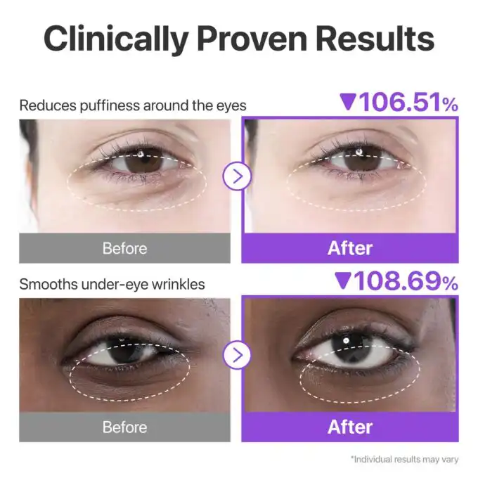 numbuzin No.9 Eye Patches, NAD+ Collagen Gel Eye Masks - Image 3