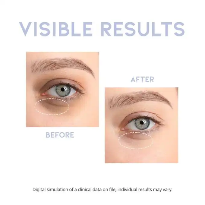 OOTD Intensive Eye Serum - Image 4