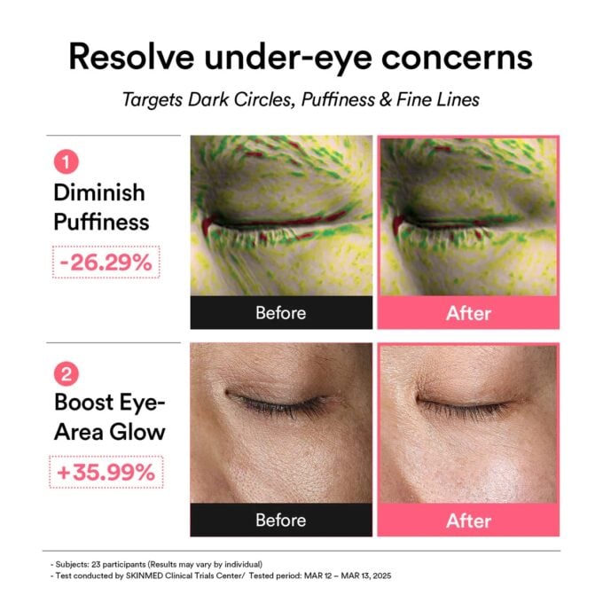 ABIB PDRN Retinal Eye Patch Glow Jelly - Image 8