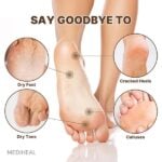 Mediheal Foot Mask (5 Pack) - Image 3